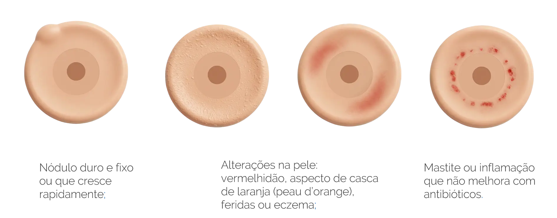 Sinais de alerta do câncer de mama
